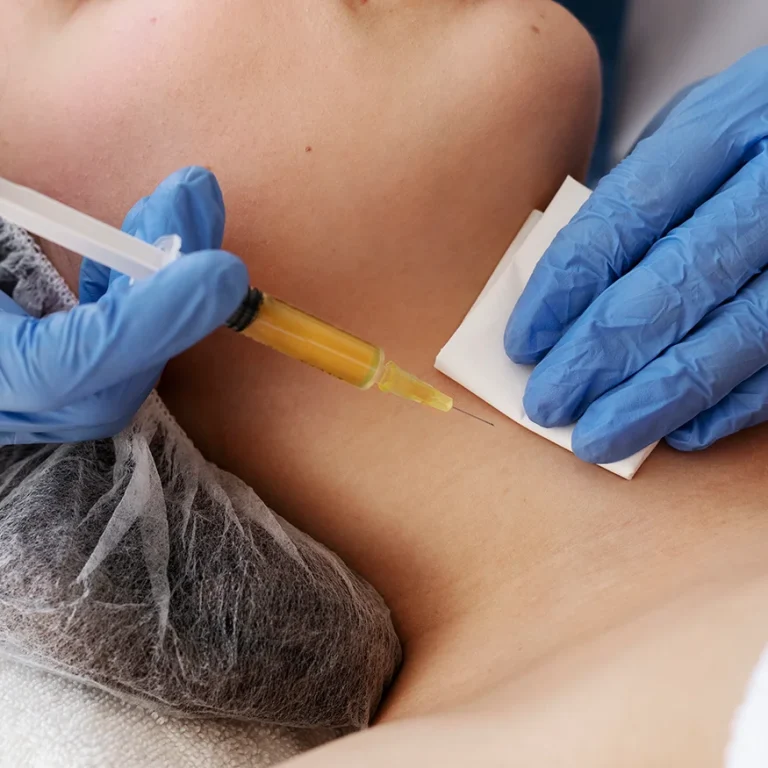 FatDissolvingInjection2